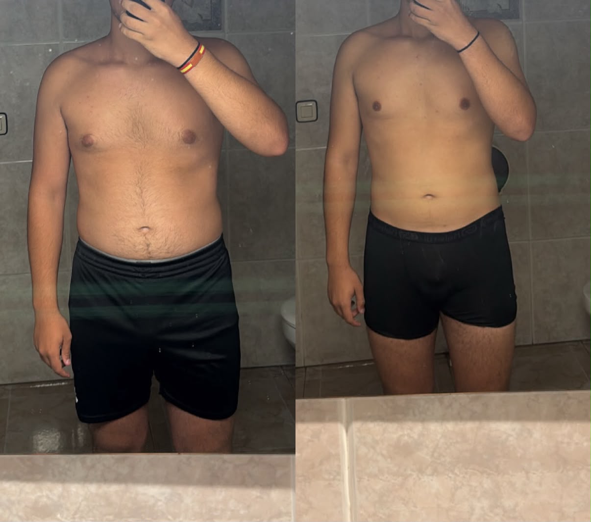 Antes y después: pérdida de grasa; evolución frontal